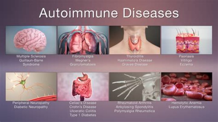 Are you immunocompromised if you have an autoimmune disease?