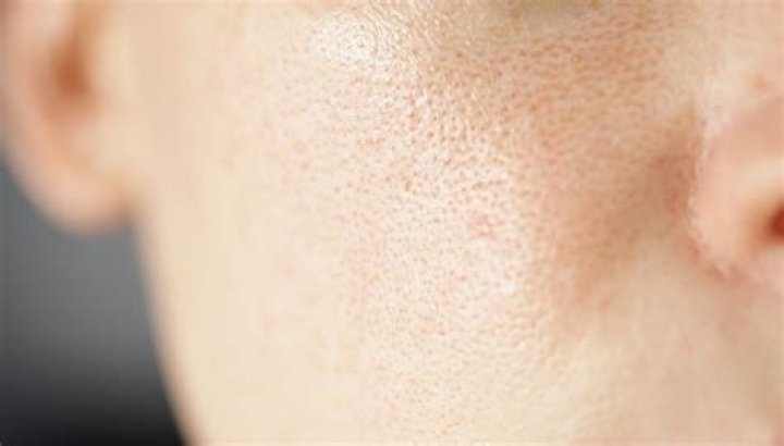 Can aloe vera tighten pores?