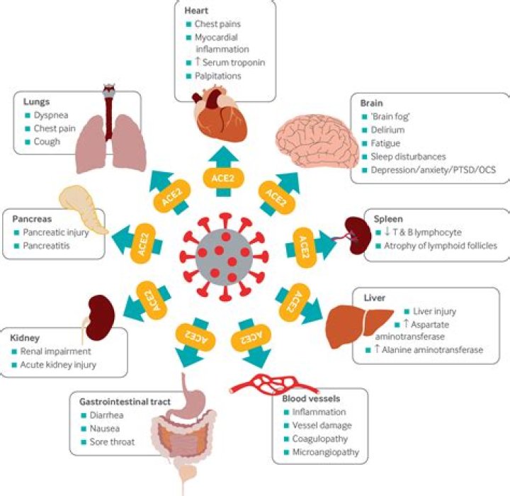 Can Covid trigger chronic fatigue?
