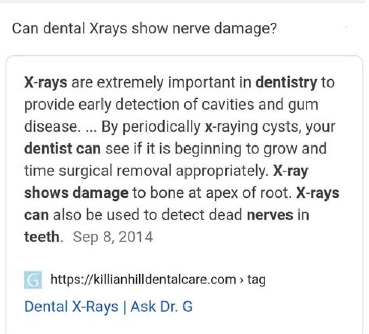 Can dental Xrays show nerve damage?