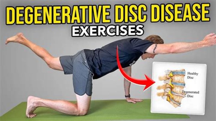 Can I still lift weights with degenerative disc disease?