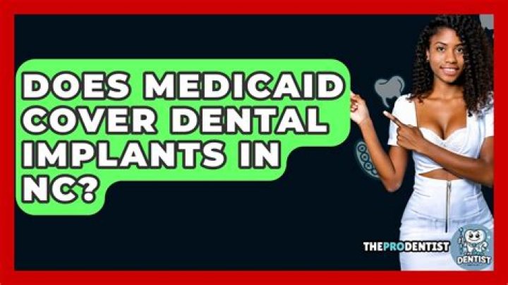 Does Medicaid in North Carolina Cover Dental Implants - Everything You Need to Know