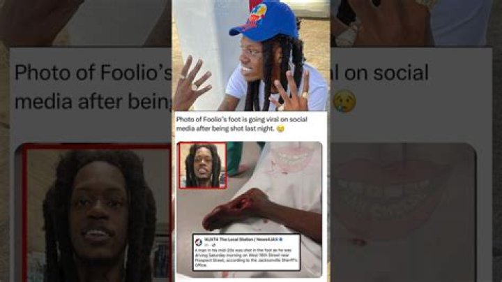 Unveiling Foolio's Face Twitter: The Intriguing World of a Rising Star