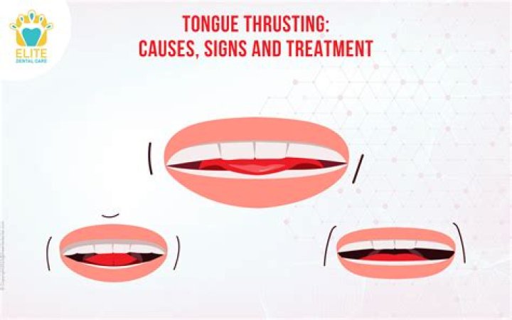 How can an adult stop tongue thrusting?