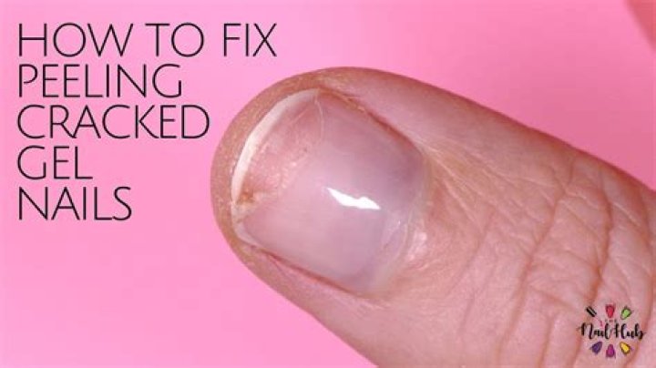 How do I fix peeling nails?