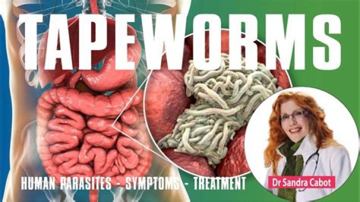 How do you diagnose a tapeworm?