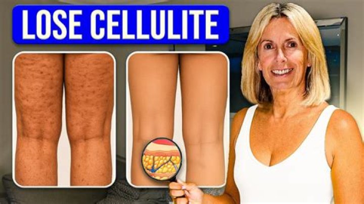 How do you make cellulite on your legs look better?