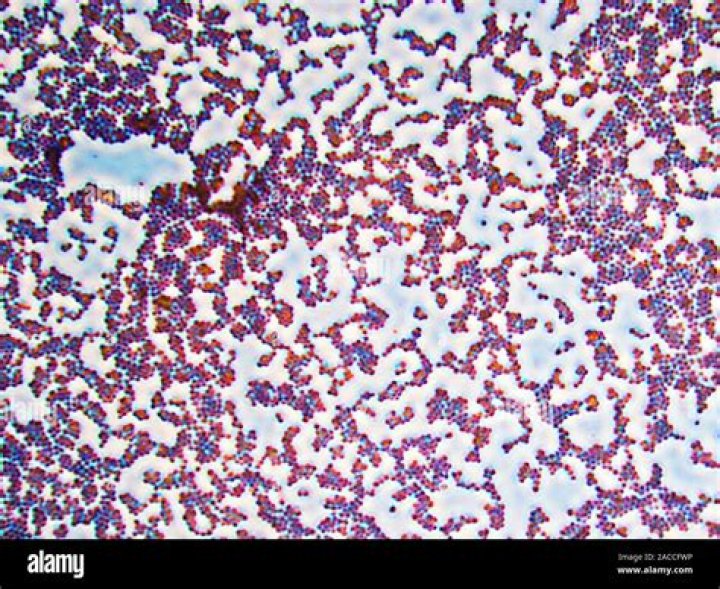 Is Staphylococcus aureus an STD?