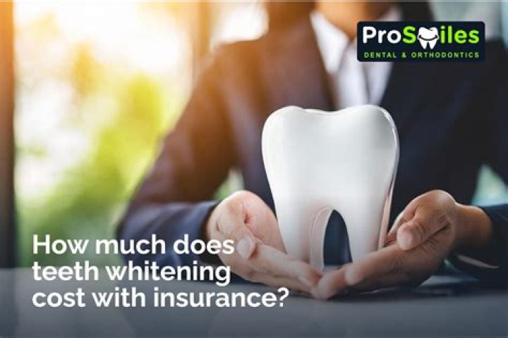 Coverage Explained: Teeth Whitening Insurance Policies