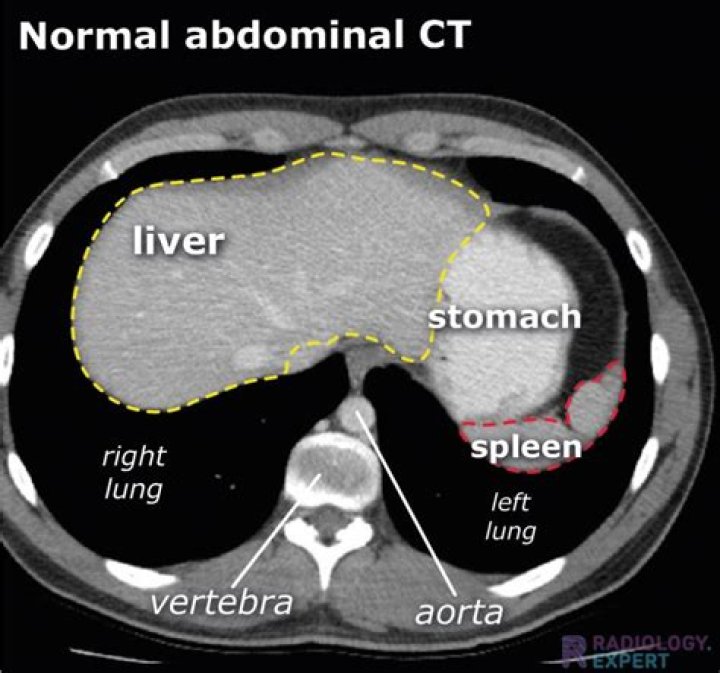 What can a stomach CT scan show?