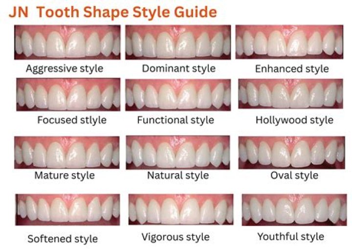 What do shovel teeth mean?