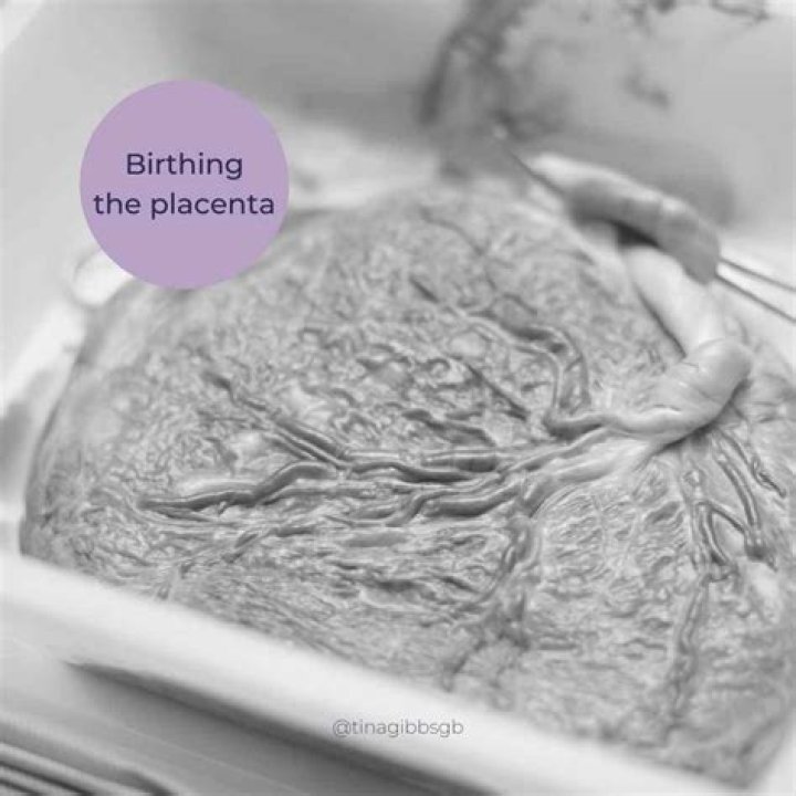What does a healthy placenta look like?