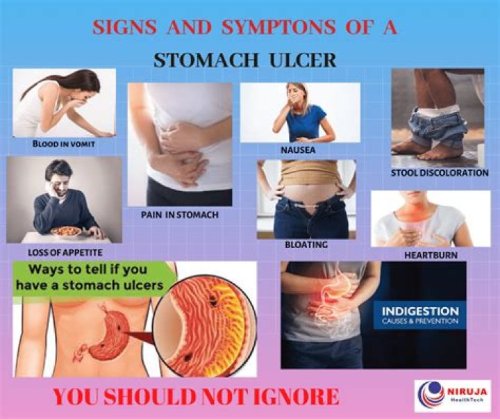 What does stress ulcer feel like?