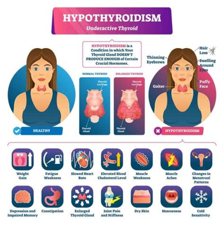 What does your thyroid do in a woman?
