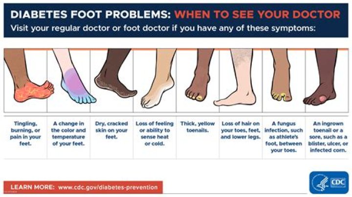 Why do diabetics get their legs cut off?